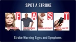 Holiday Heart Attacks:  Stroke Warning Signs and Symptoms